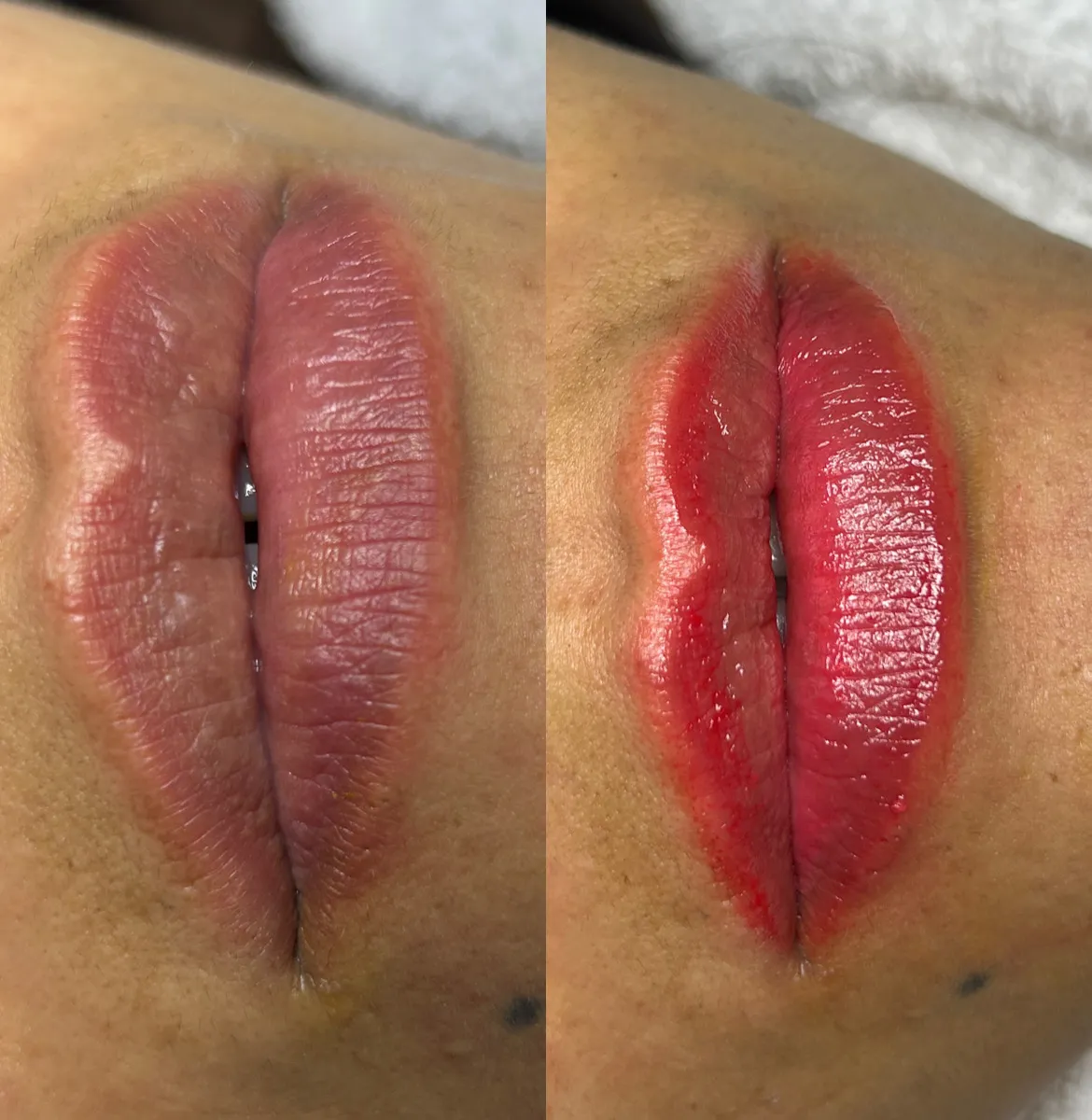 Tratamiento BB-Lips en Yeya Fisio-Spa
