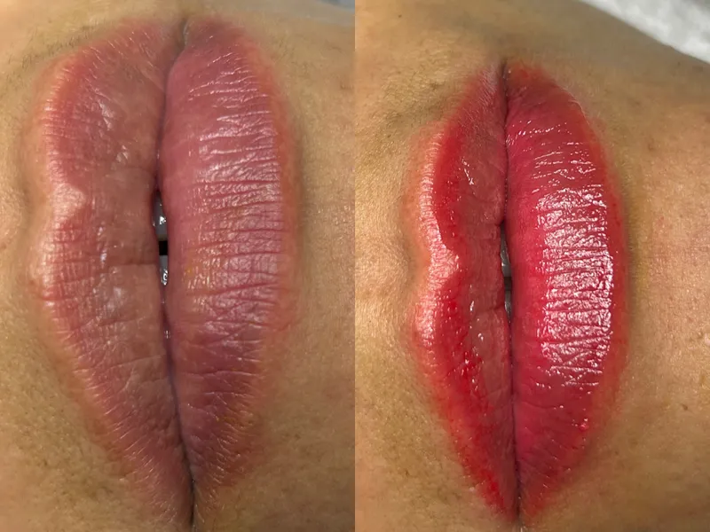 Tratamiento BB-Lips en Yeya Fisio-Spa