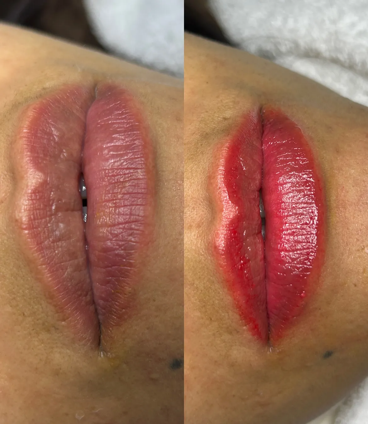 Tratamiento BB-Lips en Yeya Fisio-Spa